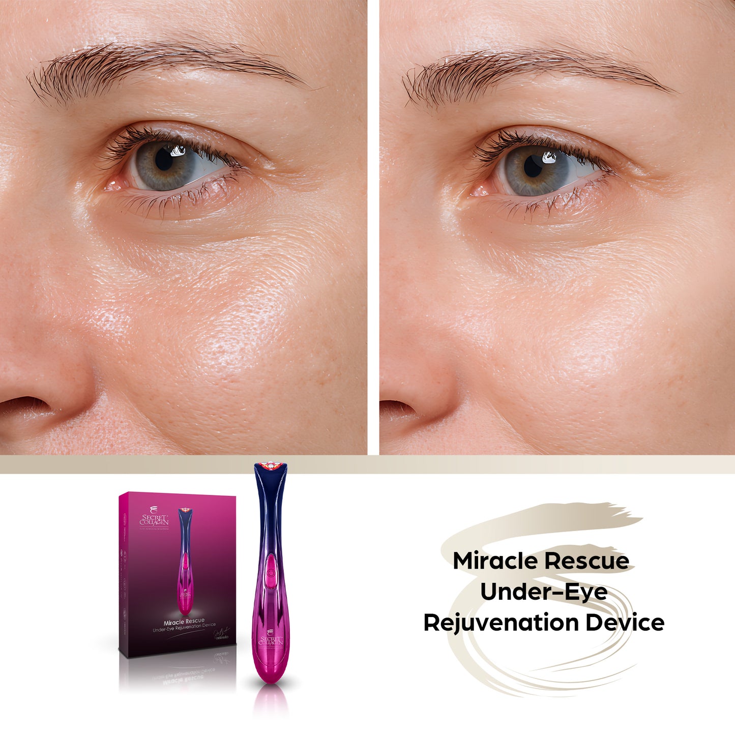 Miracle Rescue Under-Eye Rejuvenation Device