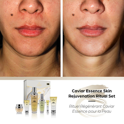 Caviar Essence Skin Rejuvenation Ritual Set