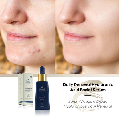 Daily Renewal Hyaluronic Acid Facial Serum