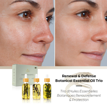 Renewal & Defense Botanical Essential Oil Trio