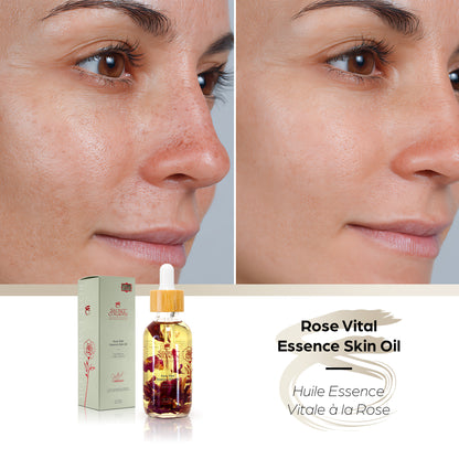 Rose Vital Essence Skin Oil