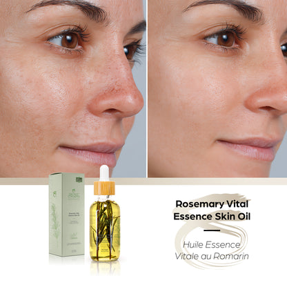 Rosemary Vital Essence Skin Oil