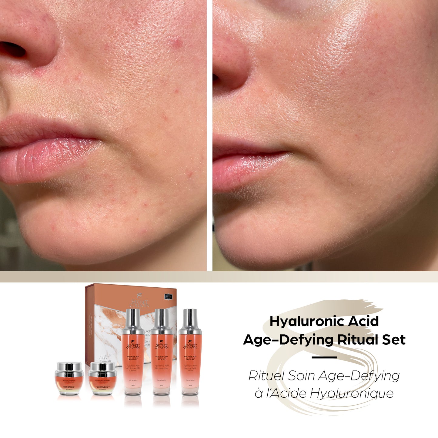 Hyaluronic Acid Age-Defying Ritual Set