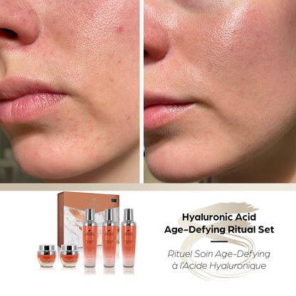 Hyaluronic Acid Age-Defying Ritual Set