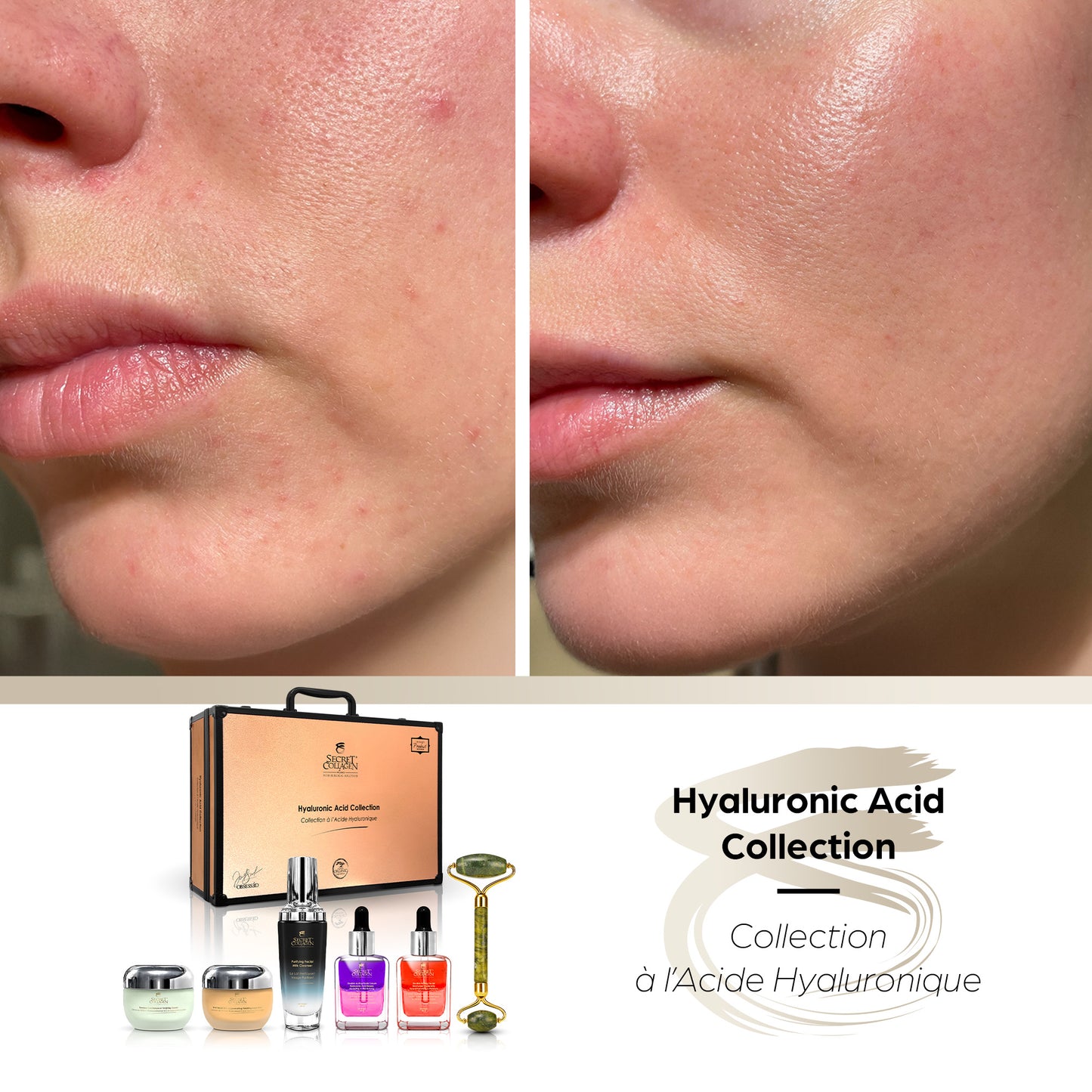 Hyaluronic Acid Collection