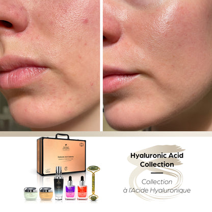 Hyaluronic Acid Collection