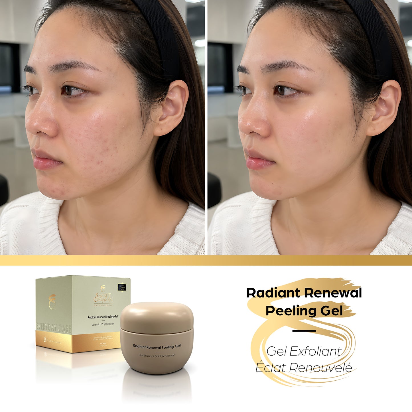 Radiant Renewal Peeling Gel