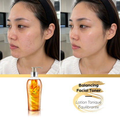 Balancing Facial Toner