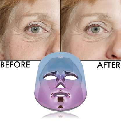 Flawless Face LED Mask | Multi-Purpose Skin Care LED Mask | Cordless New Generation